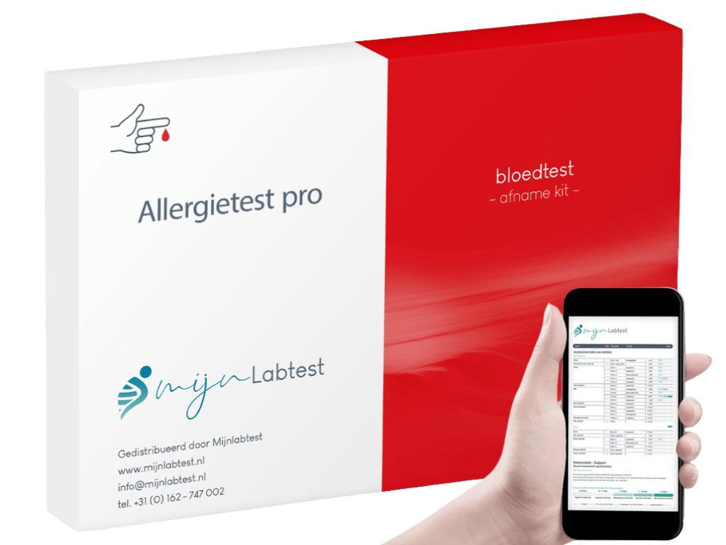 De verpakking van de allergietest pro De verpakking van de allergietest pro