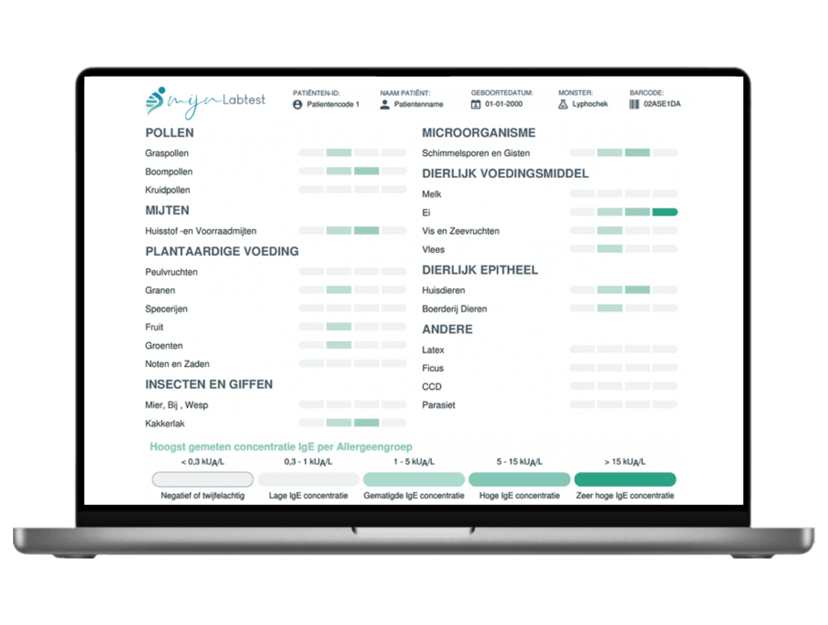In de onderzoeksuitslag zie je in een oogopslag of je allergisch bent In de onderzoeksuitslag zie je in een oogopslag of je allergisch bent