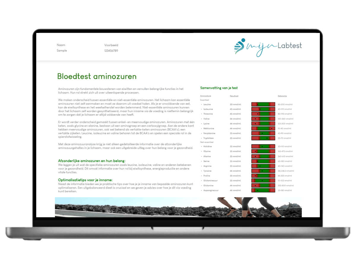 Hierbij jouw resultaat van jouw aminozuren bloedtest