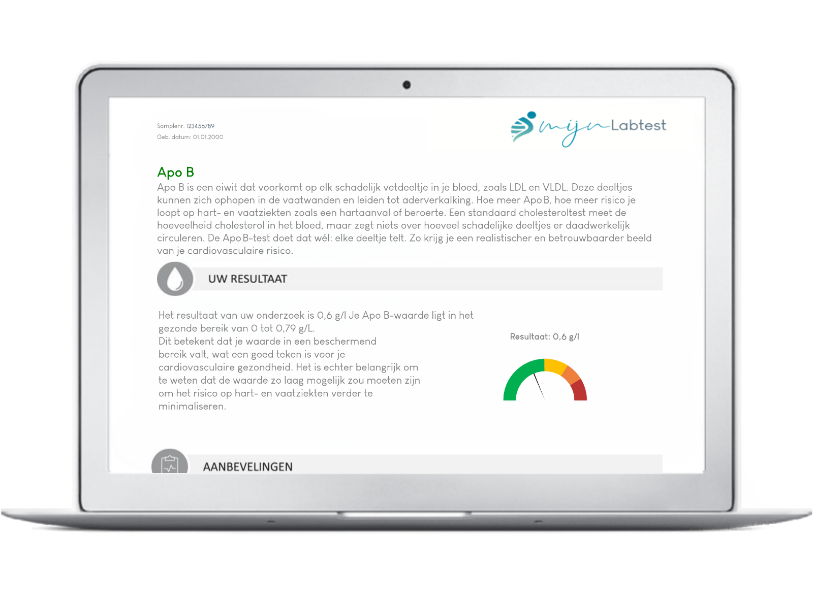 Zo wordt het resultaat van jouw ApoB test weergegeven Zo wordt het resultaat van jouw ApoB test weergegeven