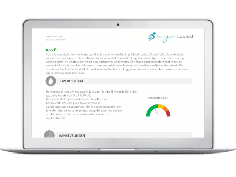Zo ziet je ApoB uitslag er uit deze zit in je Cardio profiel uitslag. Zo ziet je ApoB uitslag er uit deze zit in je Cardio profiel uitslag.