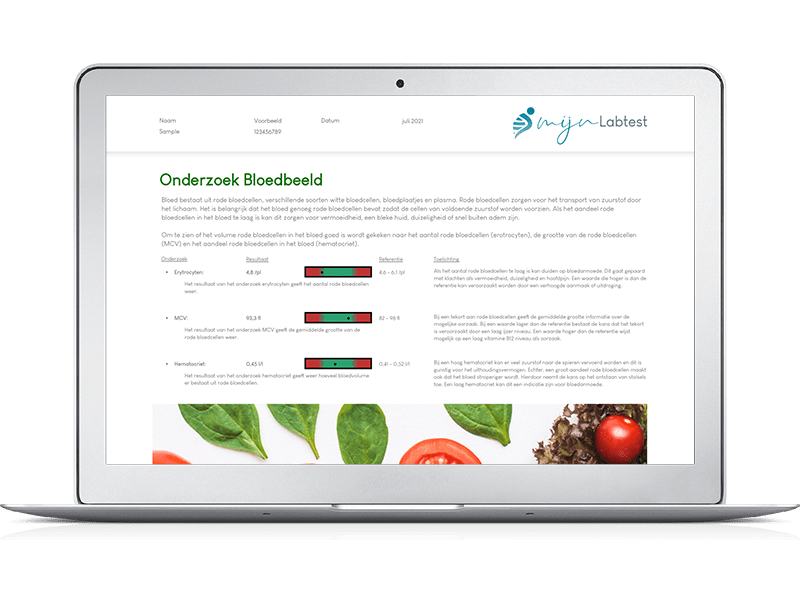 Zo ziet het resultaat van jouw bloedbeeld onderzoek eruit.