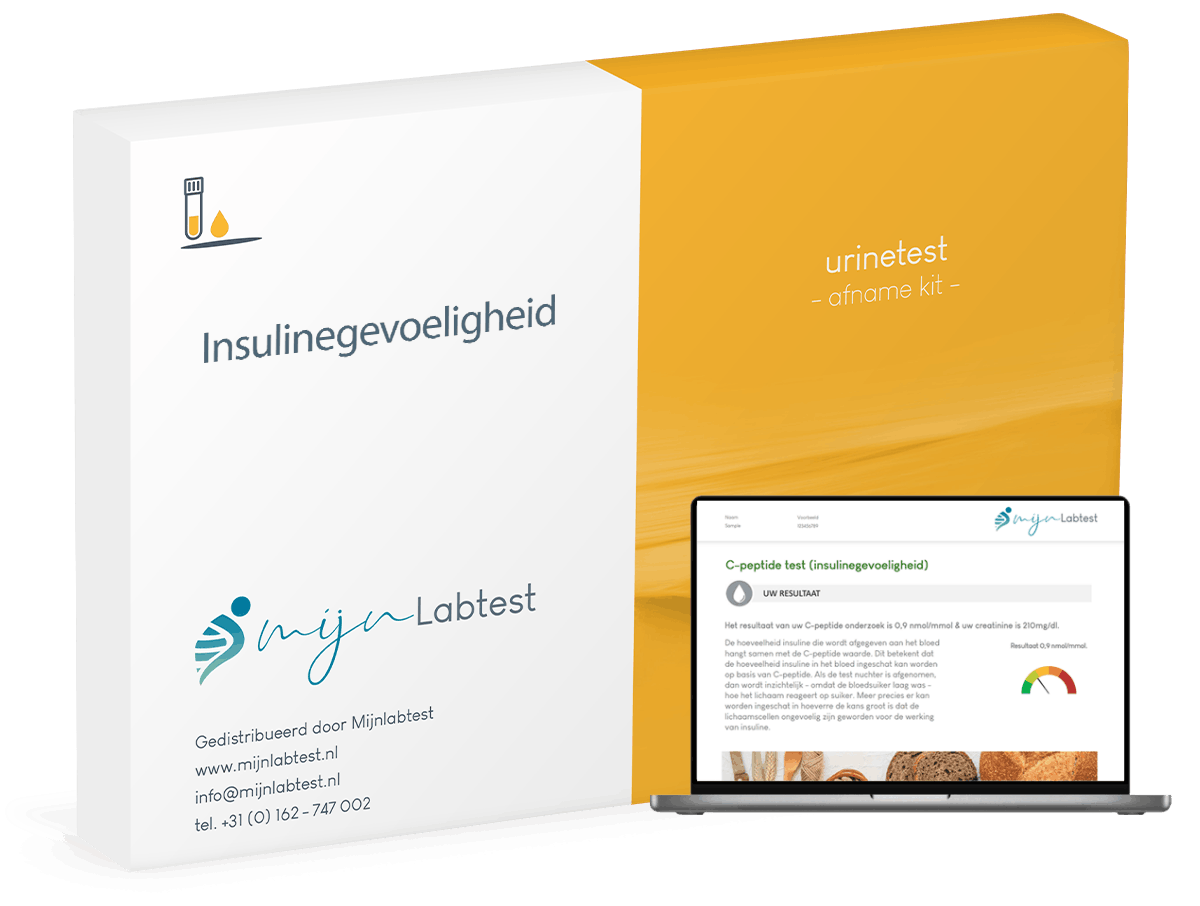 C-peptide test (insulinegevoeligheid) C-peptide test (insulinegevoeligheid)