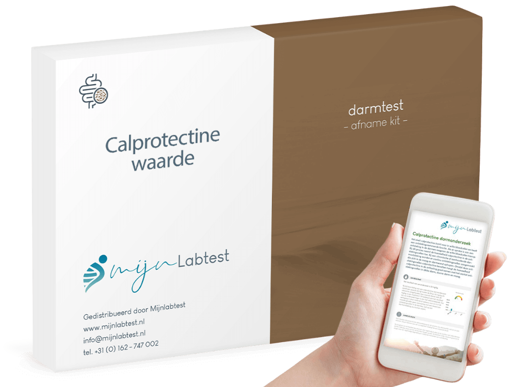 Calprotectine waarde test