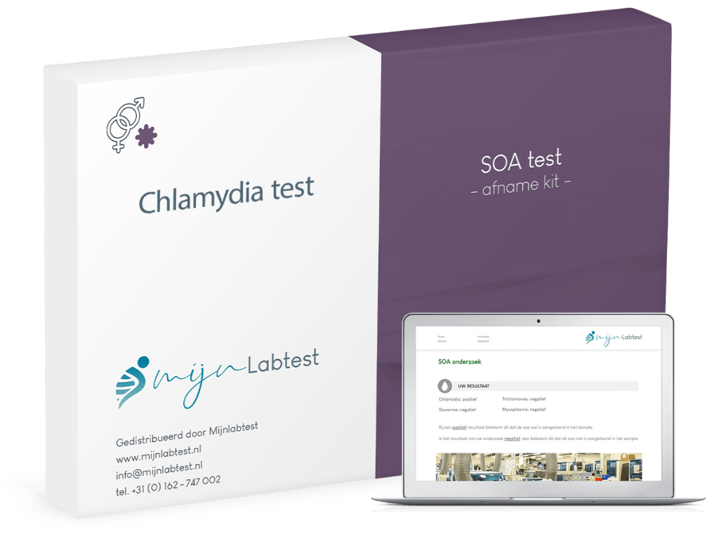 Chlamydia test