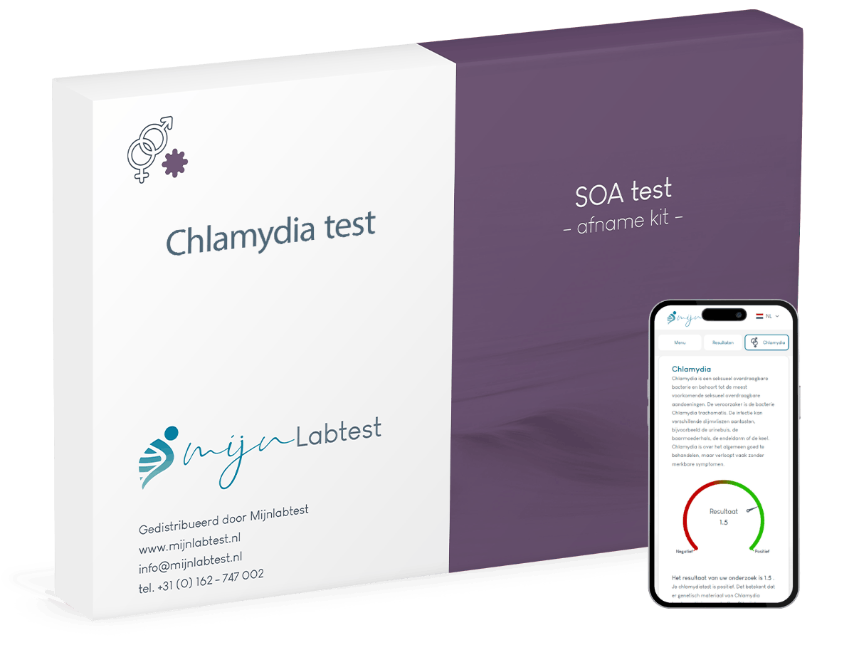 Chlamydia test