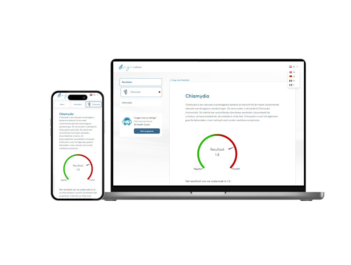 De uitslag van een chlamydia test De uitslag van een chlamydia test