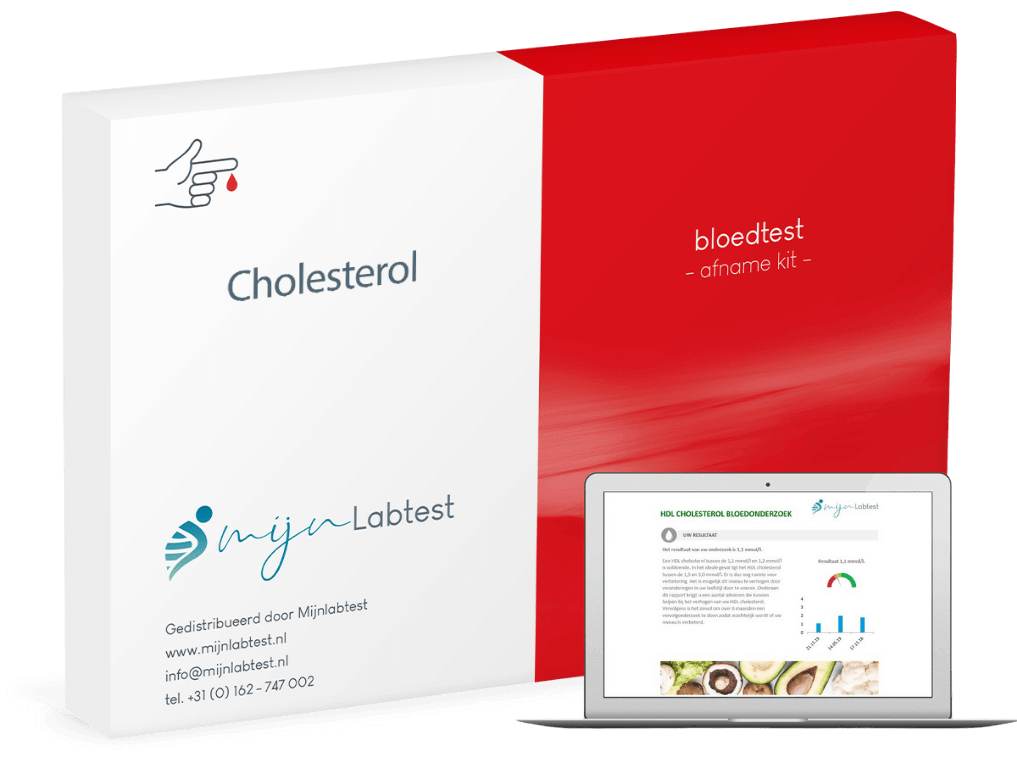 Cholesterol test