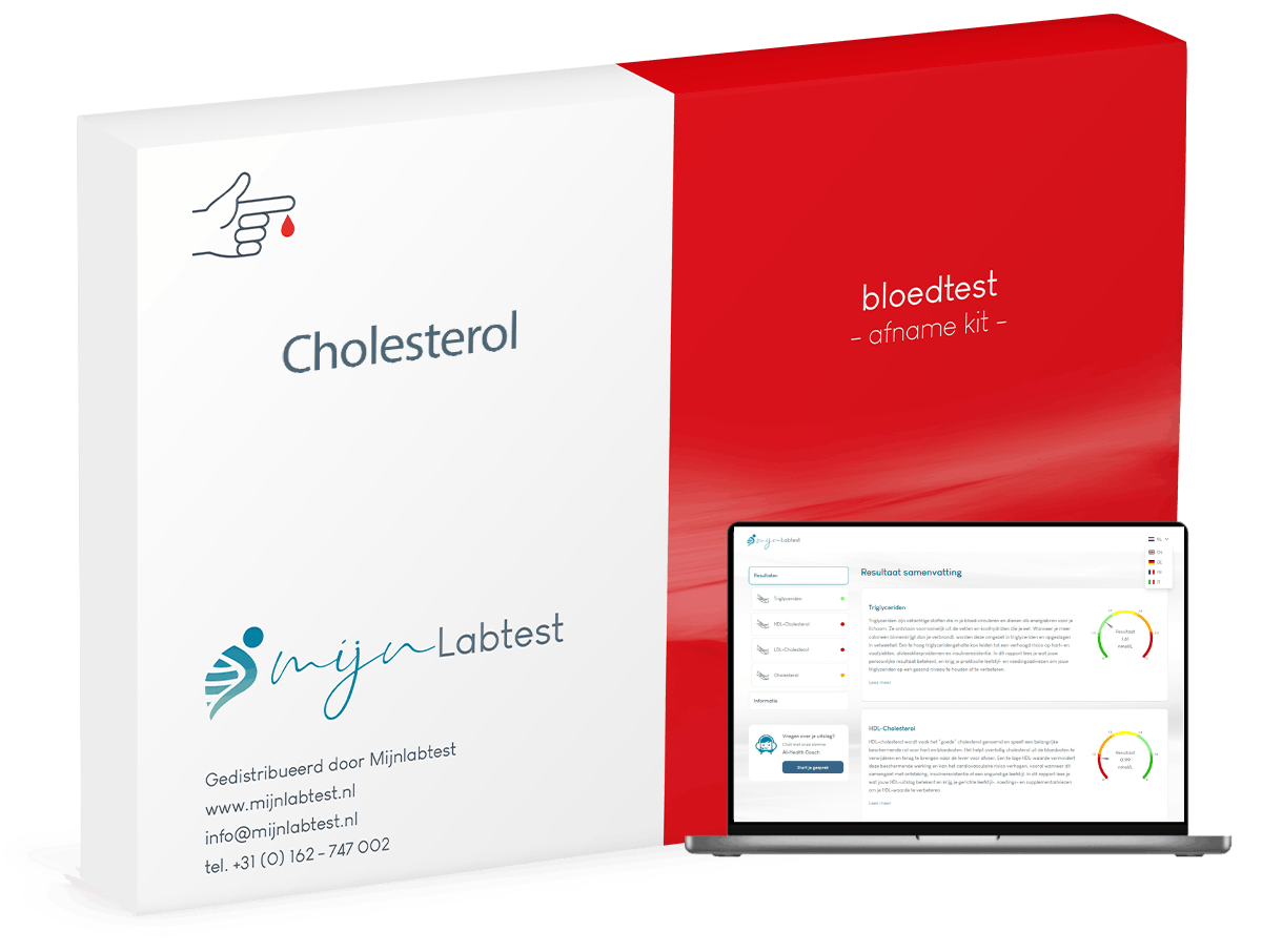 Dit is de afname kit van jouw Cholesterol test Dit is de afname kit van jouw Cholesterol test