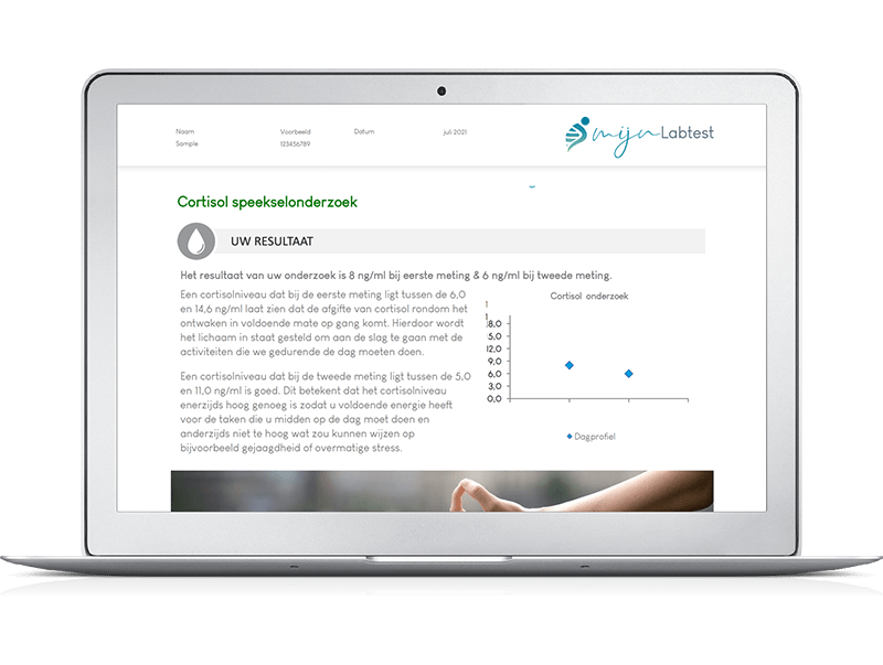 Zo ziet het resultaat van jouw  cortisol DHEA test eruit. 