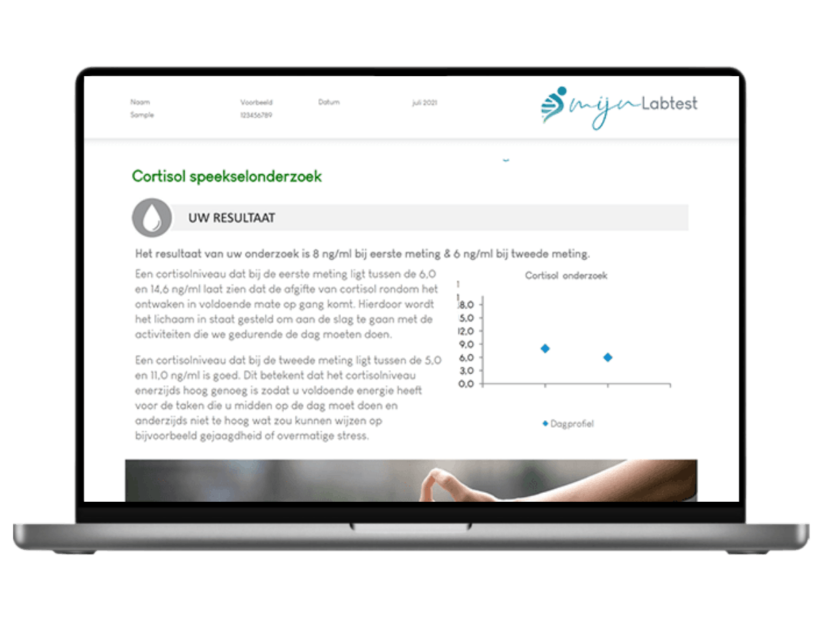 Cortisol speekselonderzoek man 