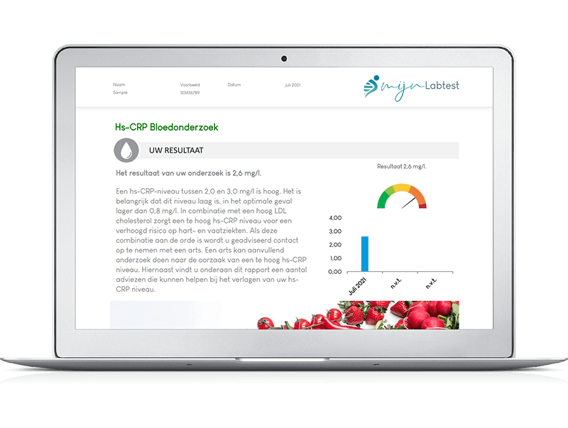 Met de uitslag van het totaal profiel XL bloedonderzoek kun je zelf de regie nemen over je gezondheid. 