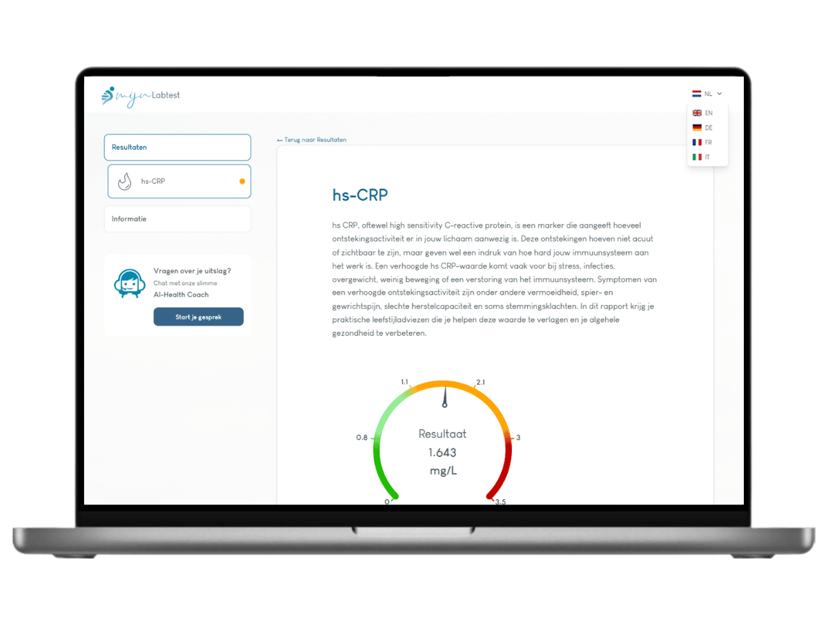 Voorbeeldrapport CRP test