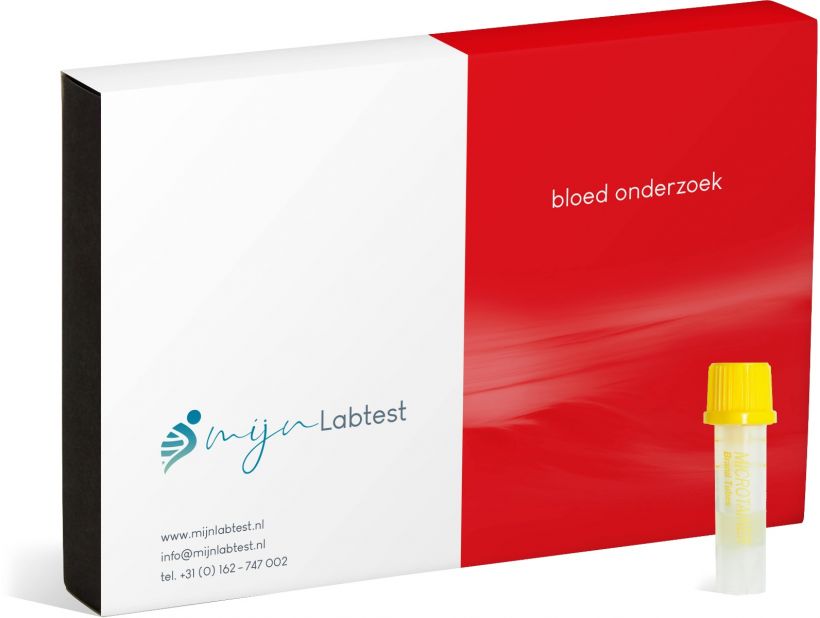 Wat is vitamine B12 en hoe je je vitamine B12 waarde testen Mijnlabtest.nl Wat is vitamine B12 en hoe je je vitamine B12 waarde testen Mijnlabtest.nl