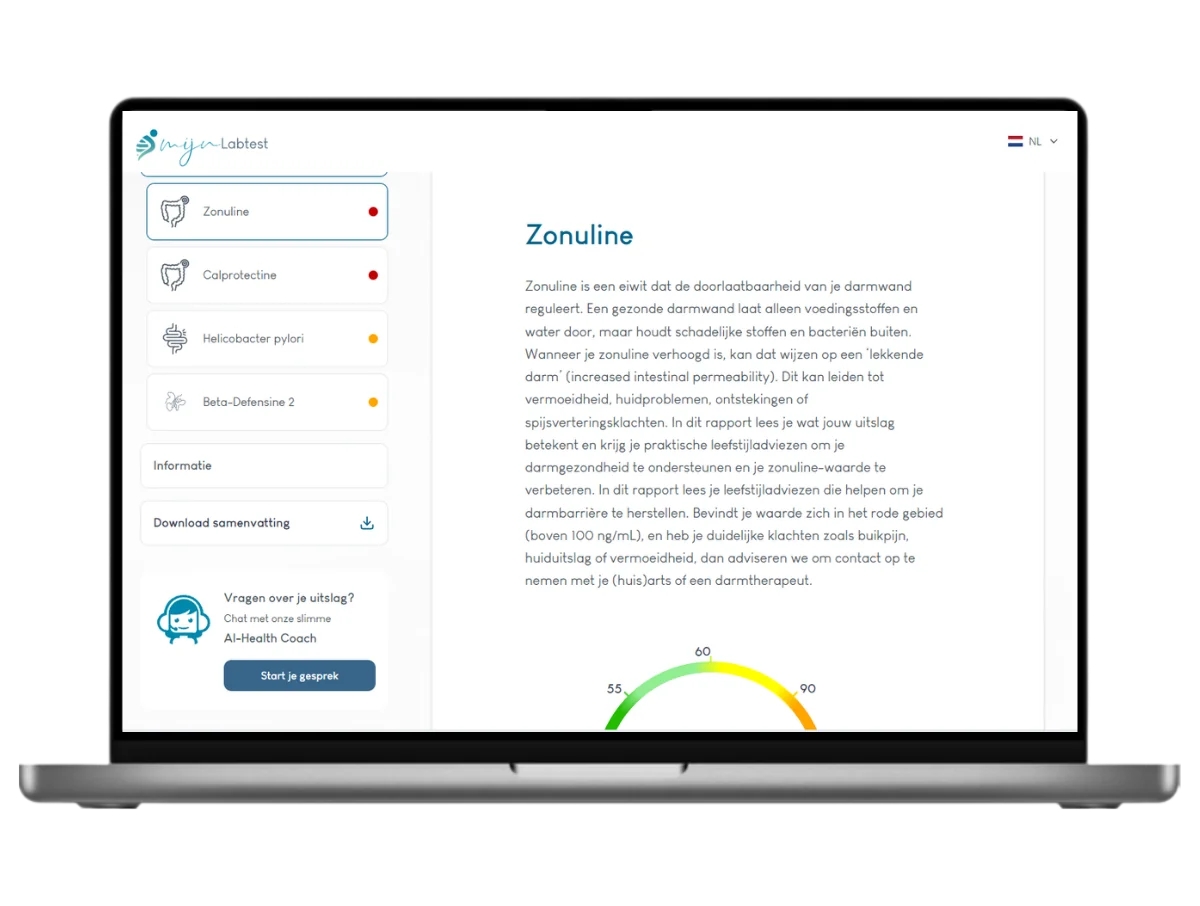 Darmtest XL Plus, meet 18 darmwaarden in één uitgebreide ontlastingstest
