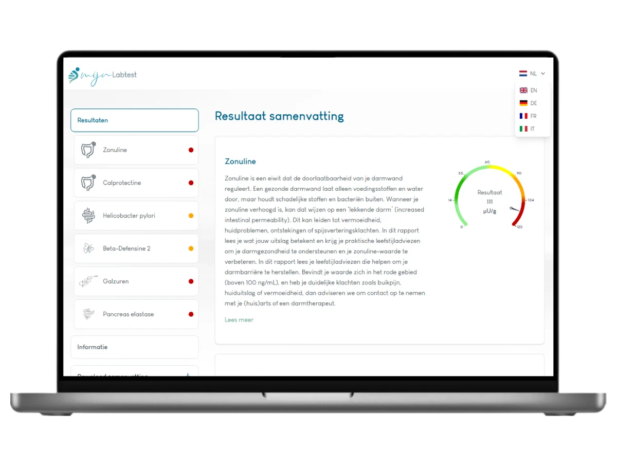 Darmtest XL Pro, Meest complete darmtest 22 waarden in één onderzoek