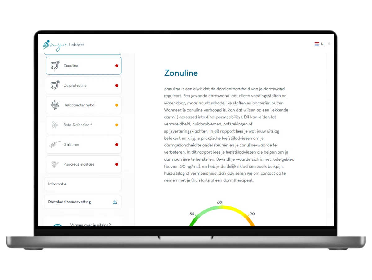 Darmtest XL Pro, Meest complete darmtest 22 waarden in één onderzoek