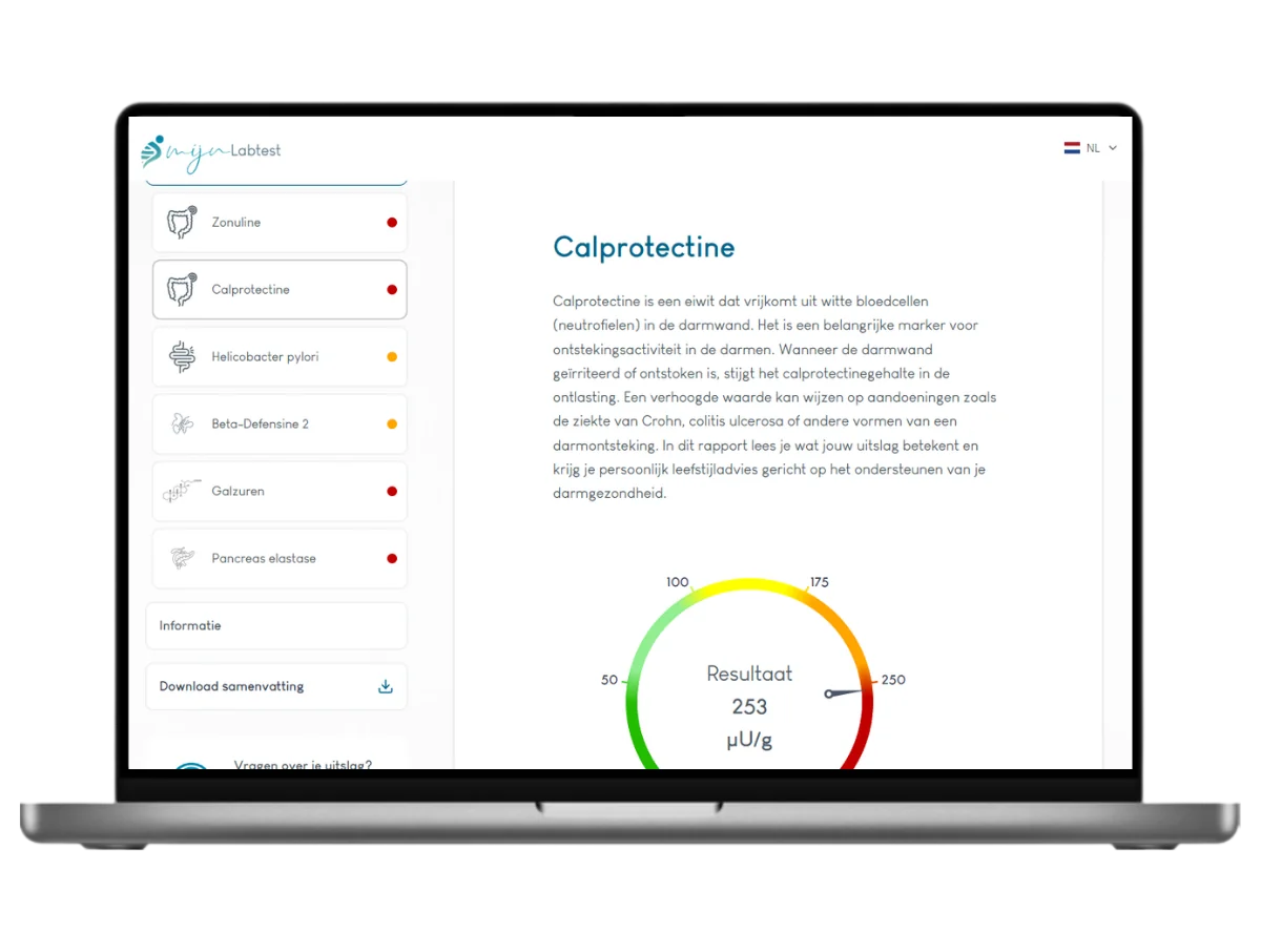 Darmtest XL Pro, Meest complete darmtest 22 waarden in één onderzoek