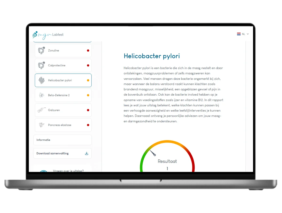 Het resultaat van een Darmtest XL Pro, Meest complete darmtest 22 waarden in één onderzoek
