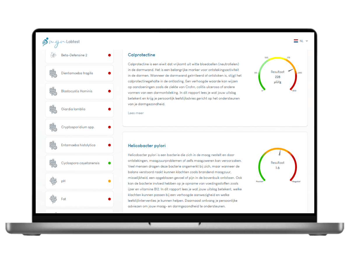 Darmtest XL Plus, meet 18 darmwaarden in één uitgebreide ontlastingstest