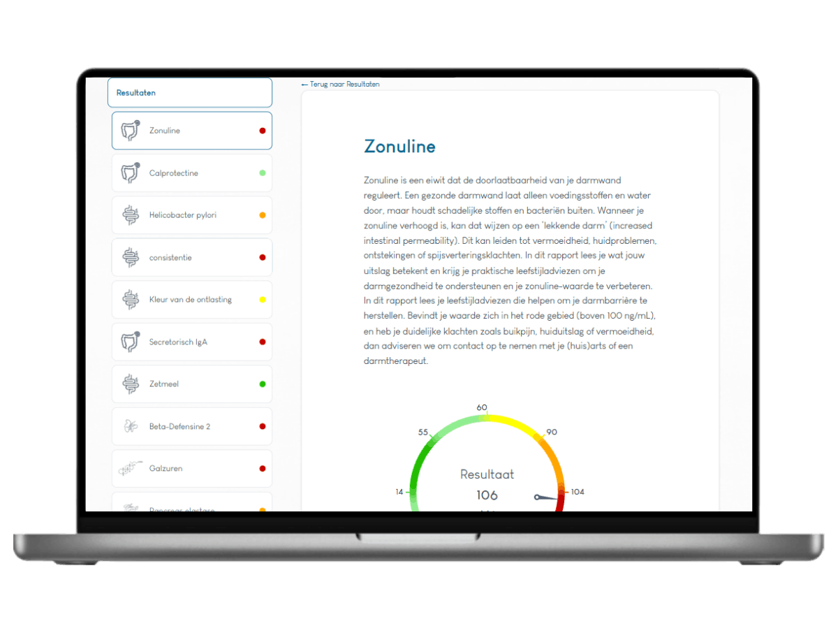 Het resultaat van een Darmtest XL Pro, Meest complete darmtest 22 waarden in één onderzoek