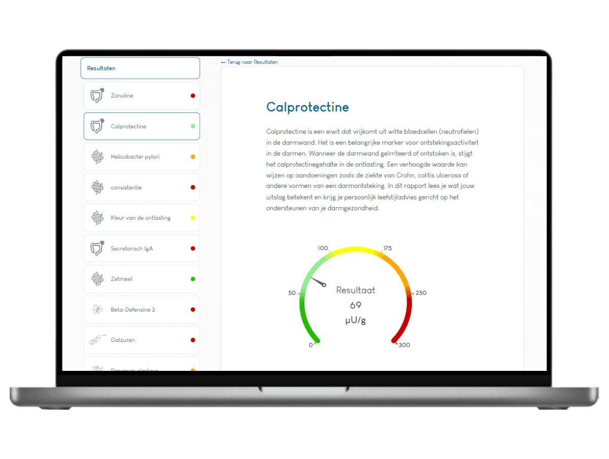 Het resultaat van een Darmtest XL Pro, Meest complete darmtest 22 waarden in één onderzoek