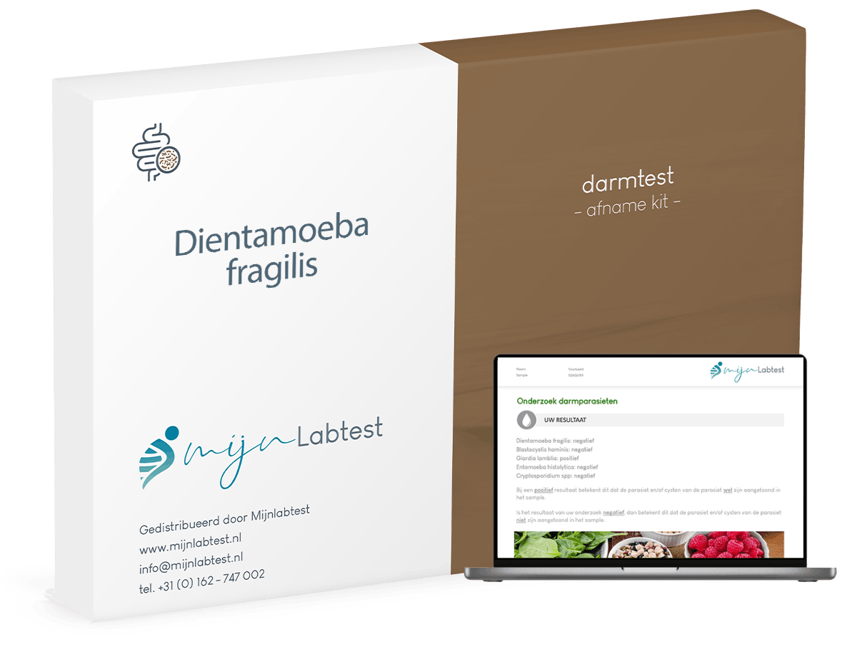 Het DNA lifestyle onderzoek wordt geleverd in een verpakking zoals op de afbeelding getoond wordt.