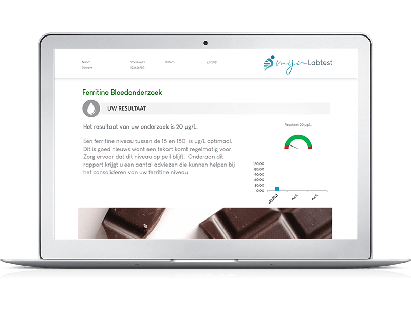 Zo zie jouw vegetariër profiel bloedtest uitslag eruit