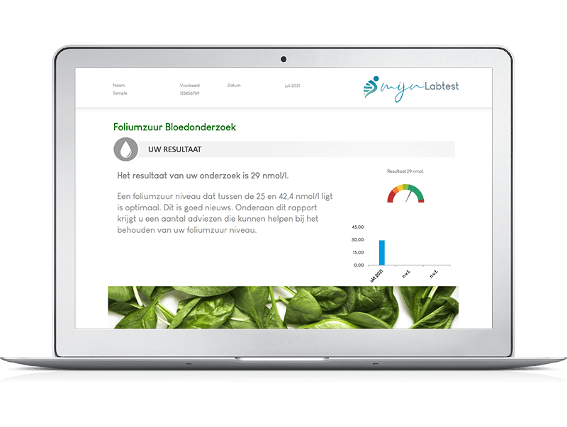 Zo ziet jouw foliumzuur bloedonderzoek eruit.