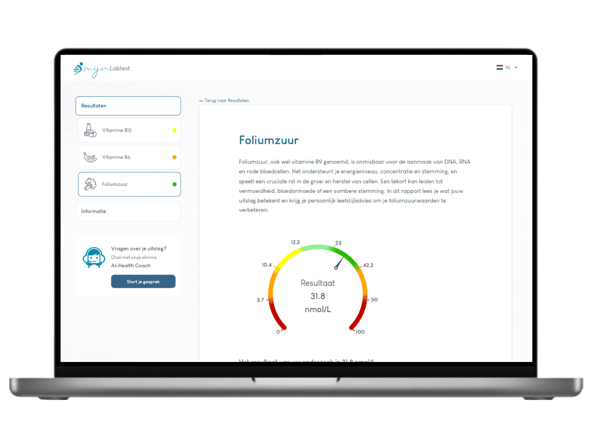 Zo ziet het resultaat van jouw vitamine B test eruit. Zo ziet het resultaat van jouw vitamine B test eruit.