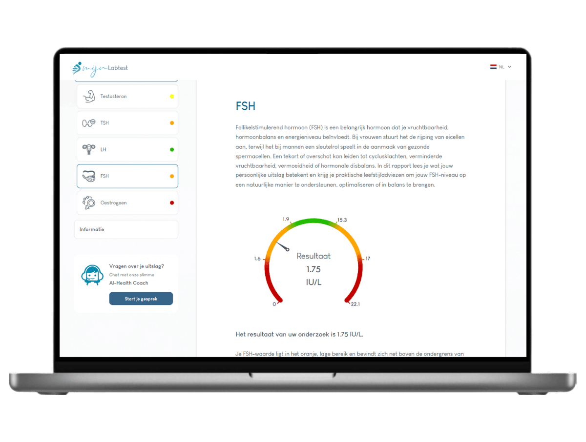 Dit is een voorbeeld van hoe je FSH bloedtest uitslag er uit ziet. Dit is een voorbeeld van hoe je FSH bloedtest uitslag er uit ziet.