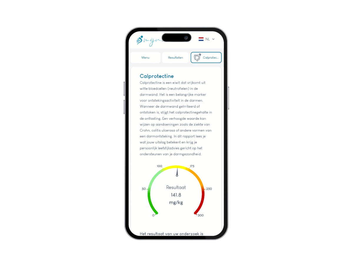 Jouw persoonlijke uitslag wordt gestuurd via een beveiligde email.