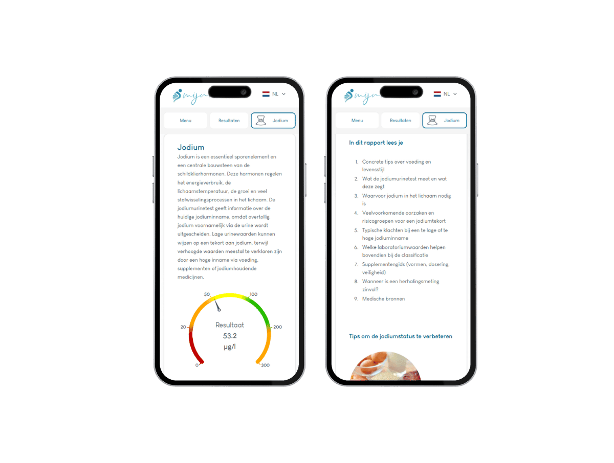 AI integratie en leefstijl advies. AI integratie en leefstijl advies.