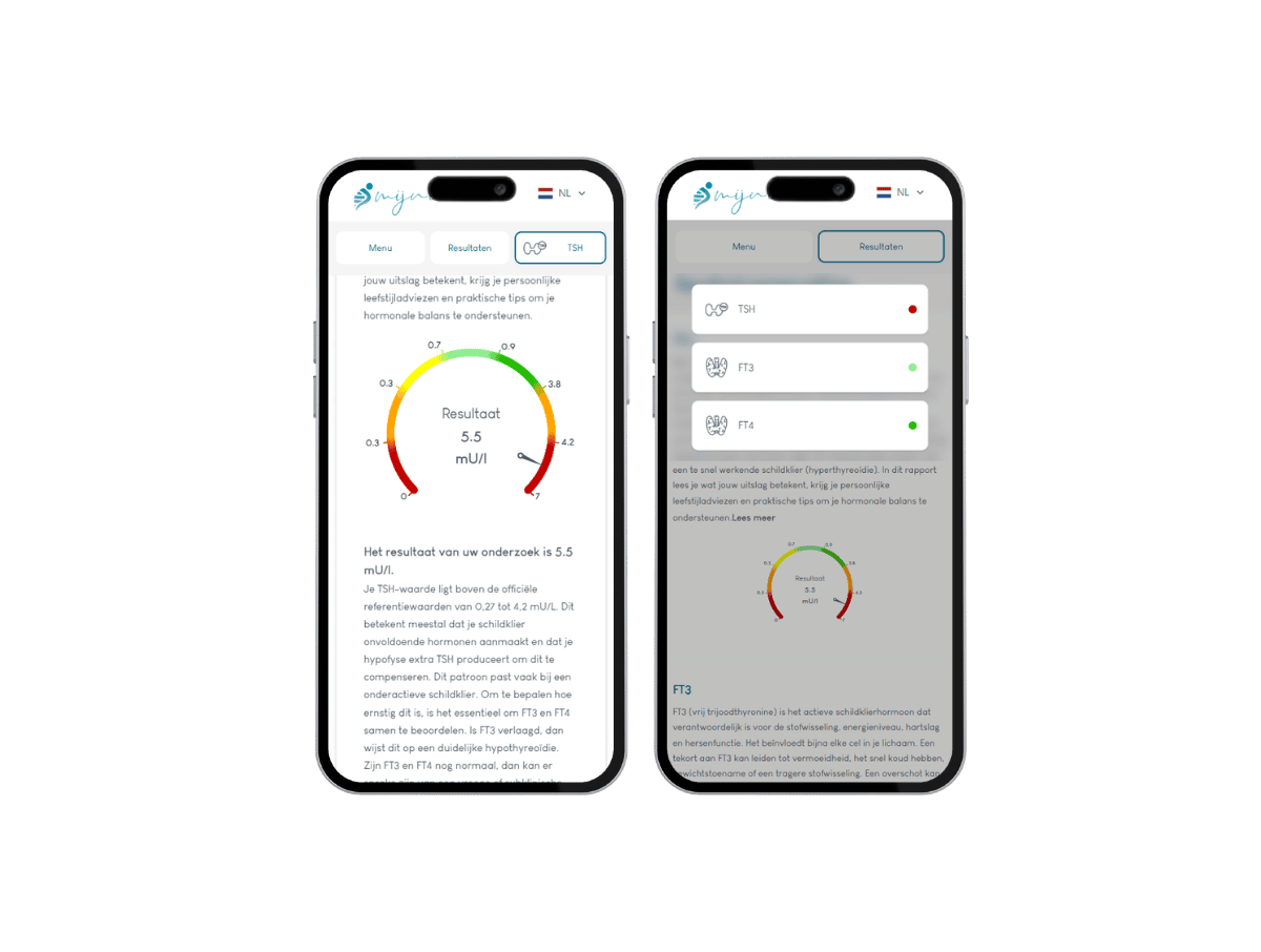 Zo ziet het resultaat van jouw schildklier profiel er uit op GSM. Het meest complete rapport met AI integratie en leefstijl advies. Zo ziet het resultaat van jouw schildklier profiel er uit op GSM. Het meest complete rapport met AI integratie en leefstijl advies.