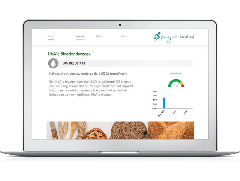 Zo ziet het resultaat van je HbA1c bloedsuiker test eruit. 