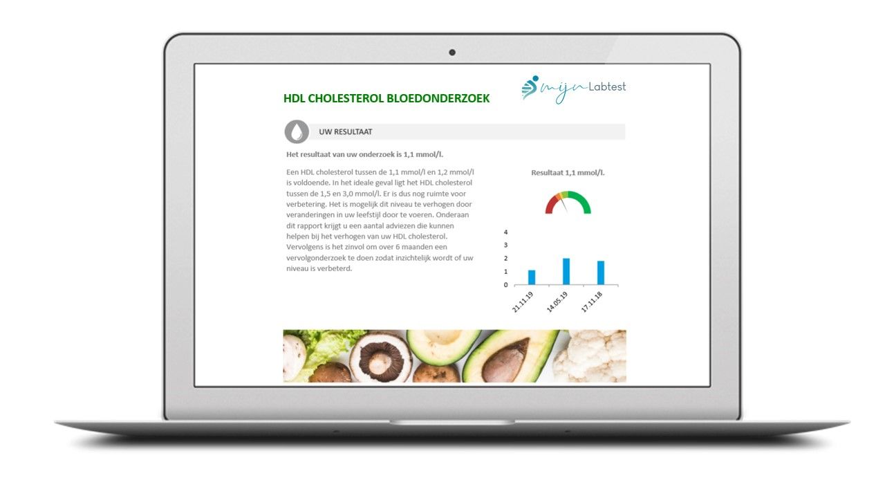 Voorbeeldrapport bloedtest Cardio profiel- Na de test kun je direct aan de slag met uitleg en tips uit het rapport 