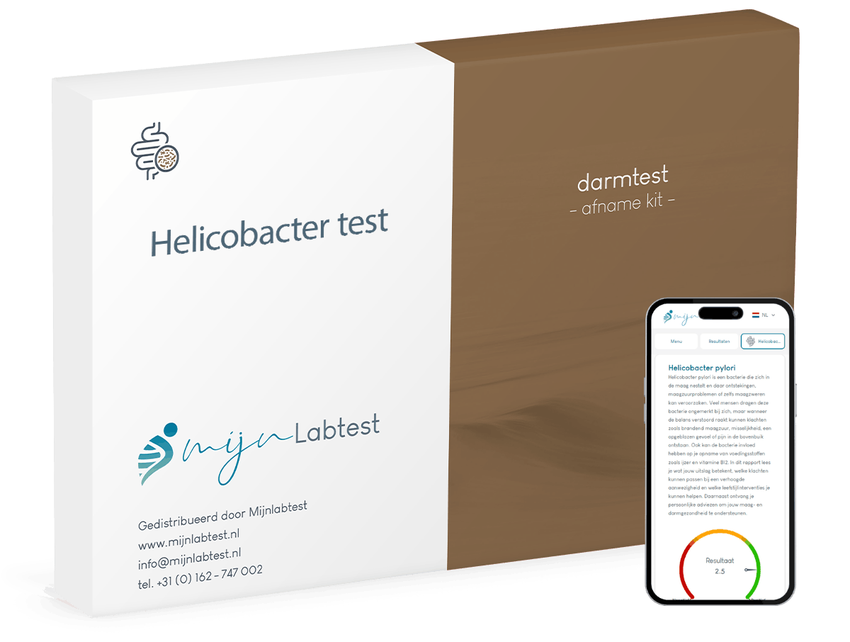 Dit is de helicobacter pylori test en het resultaat van je uitslag