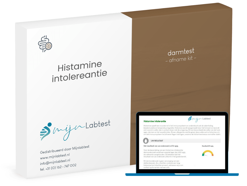 Dit is de Histamine intolerantie test + de uitslag die je krijgt