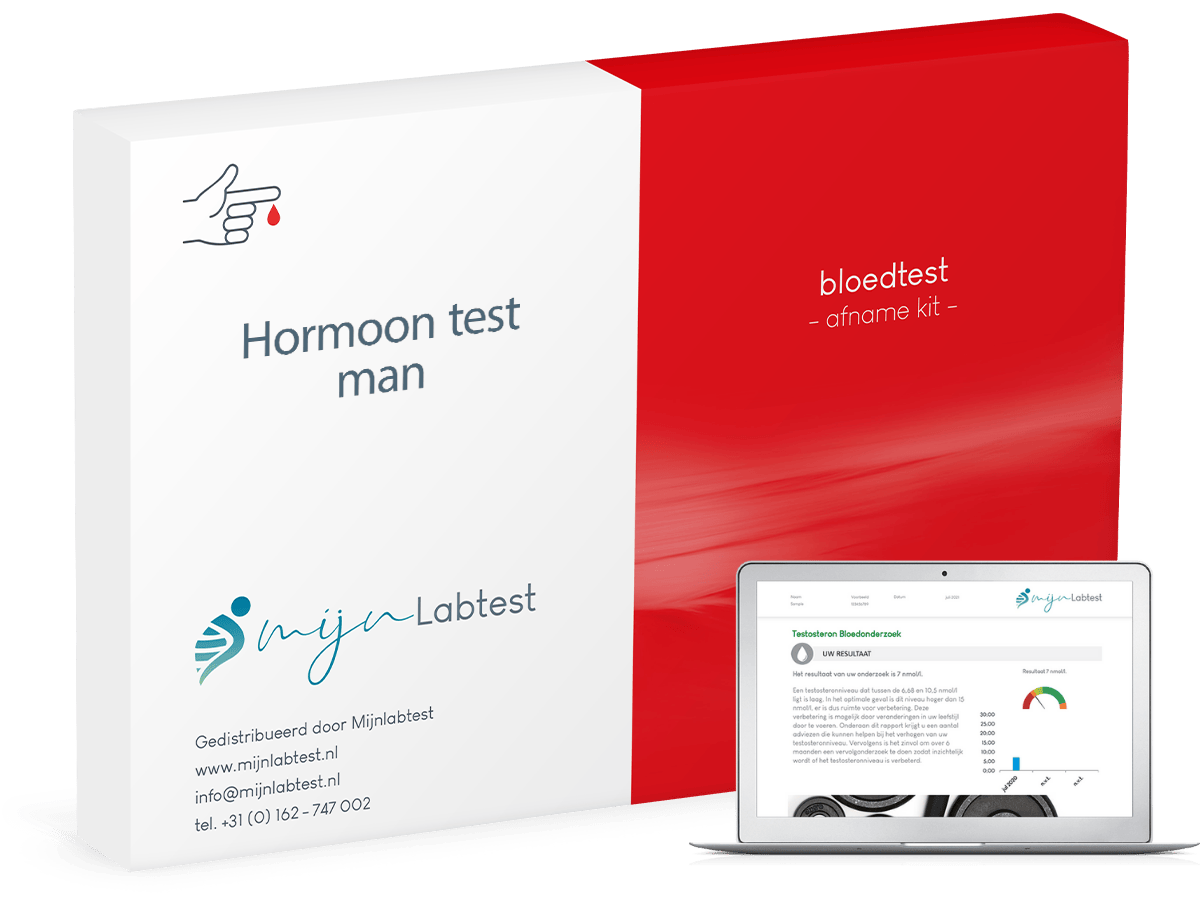 Testosteron test uitslag, onderdeel van hormoon test man Testosteron test uitslag, onderdeel van hormoon test man