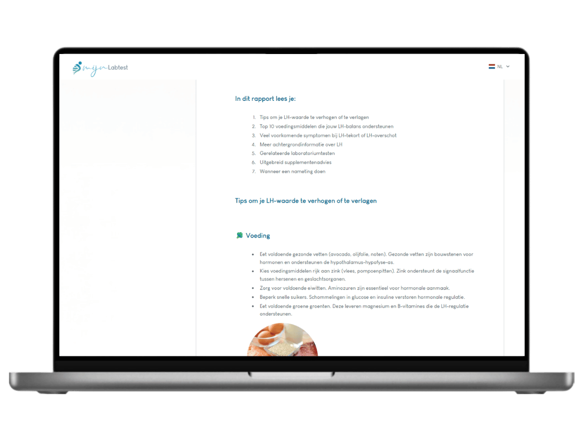 Zo ziet het resultaat van jouw LH test er uit. Het is het meest complete rapport met AI integratie en leefstijl advies. Zo ziet het resultaat van jouw LH test er uit. Het is het meest complete rapport met AI integratie en leefstijl advies.