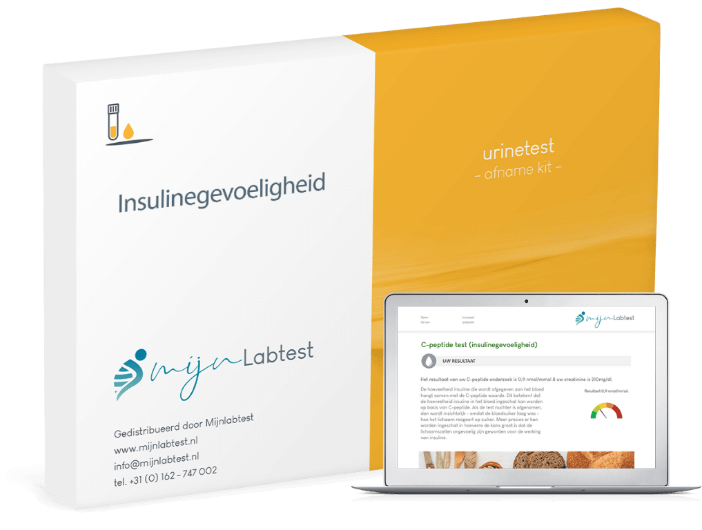 C-peptide test (insulinegevoeligheid)