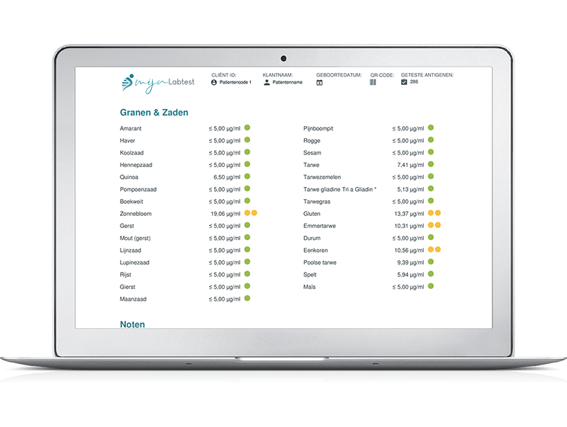 Hoofdstuk uit de uitslag over granen en zaden