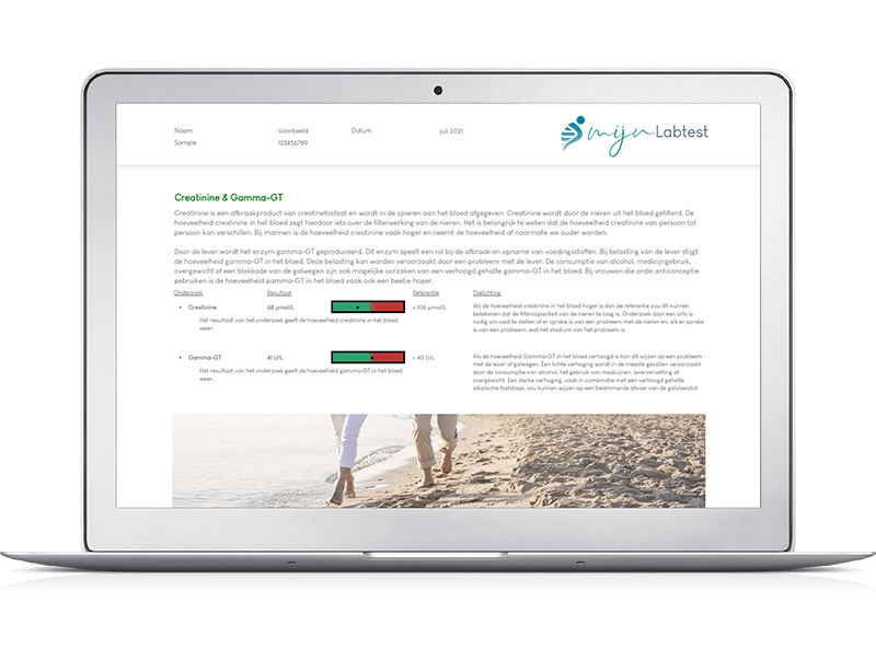 De uitslag van een zelftest nieren op desktop