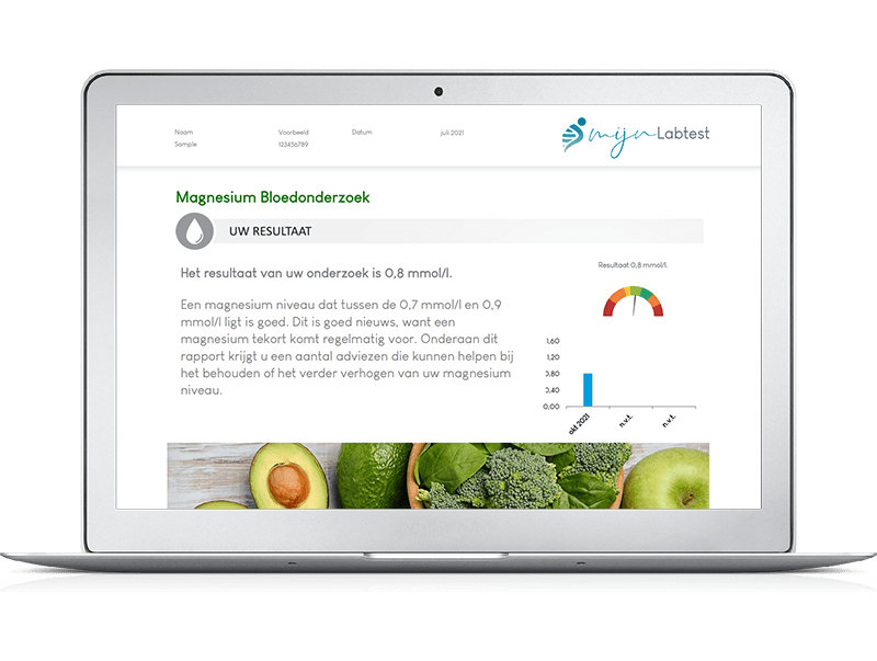 Voorbeeldrapport bloedtest magnesium tekort - Na de test kun je direct aan de slag met uitleg en tips uit het rapport 