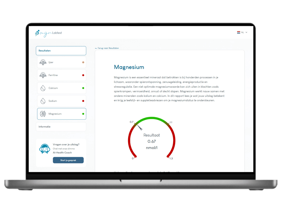Met illustraties en uitleg over je resultaat van je mineralen profiel test weet je precies wat dit voor jou betekent. Met illustraties en uitleg over je resultaat van je mineralen profiel test weet je precies wat dit voor jou betekent.