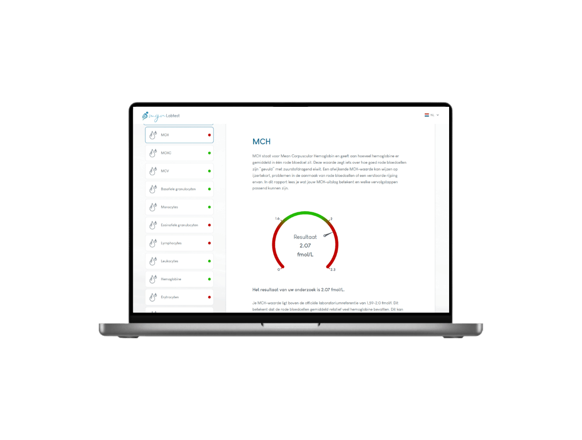 Dit is je MCH waarde uitslag, onderdeel van bloedbeeld groot