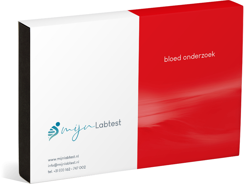 Dit is de microplastics afnamekit waarmee jij je sample kunt afnemen. Dit is de microplastics afnamekit waarmee jij je sample kunt afnemen.