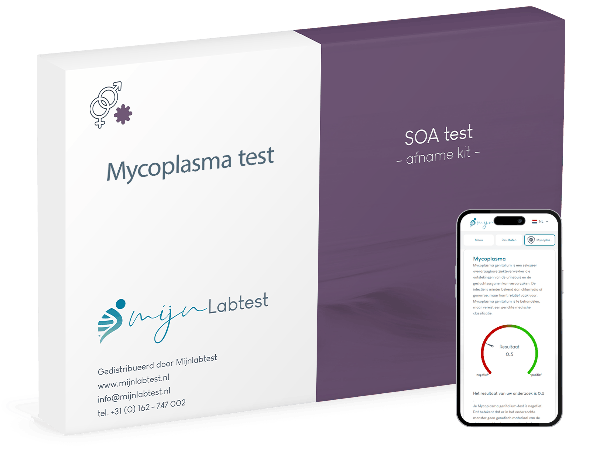 Mycoplasma test