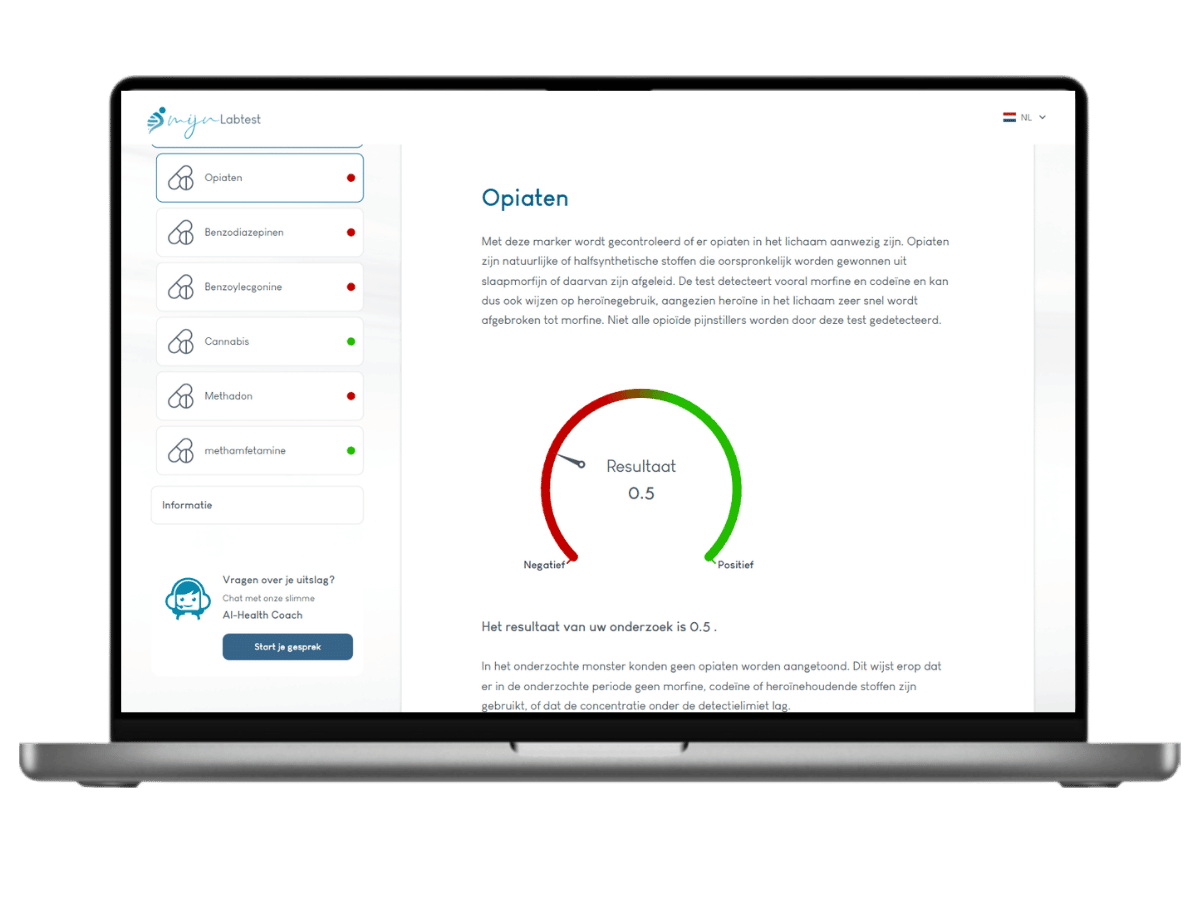 Opiaten resultaat drugs test