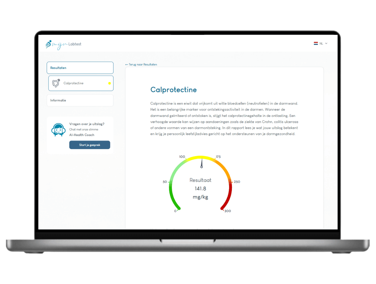 Zo ziet het resultaat van jouw Calprotectine waarde zelftest er uit. Het is het meest complete rapport met AI integratie en leefstijl advies. Zo ziet het resultaat van jouw Calprotectine waarde zelftest er uit. Het is het meest complete rapport met AI integratie en leefstijl advies.